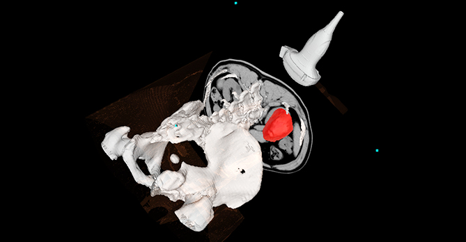 卡本医疗Venus多模态影像融合超声诊断系统